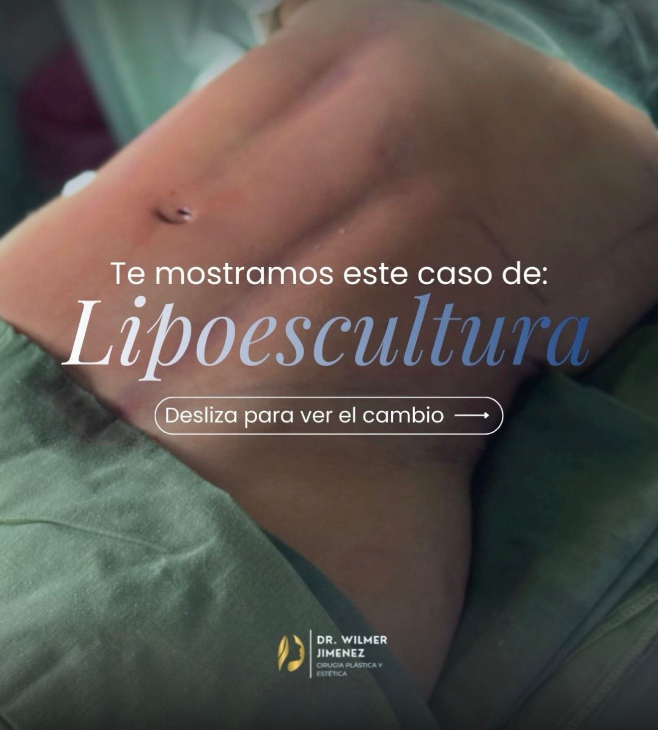 Resultado de paciente 1